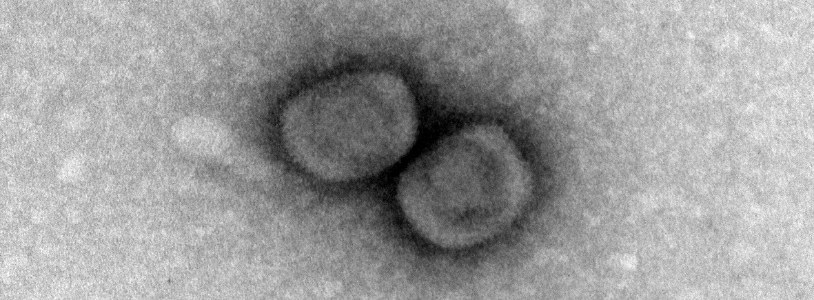 Electron Microscopy image of the Monkeypox virus