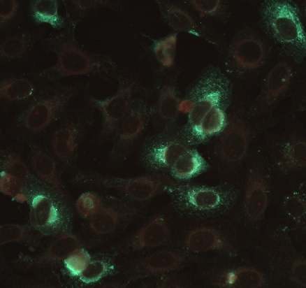 IF-image of SARS-CoV-2 (COVID-19) infected Vero cells