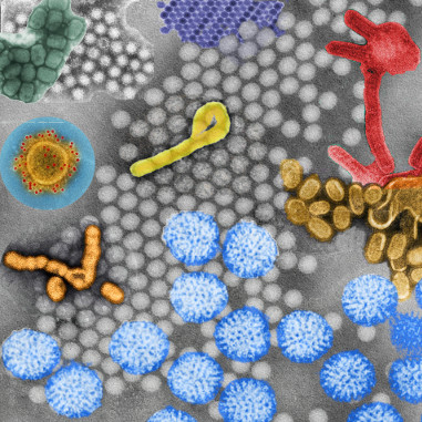 parainfluenza type 3